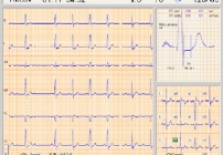  próba wysiłkowa lublin